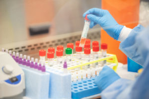 Coronavirus Testing Lab