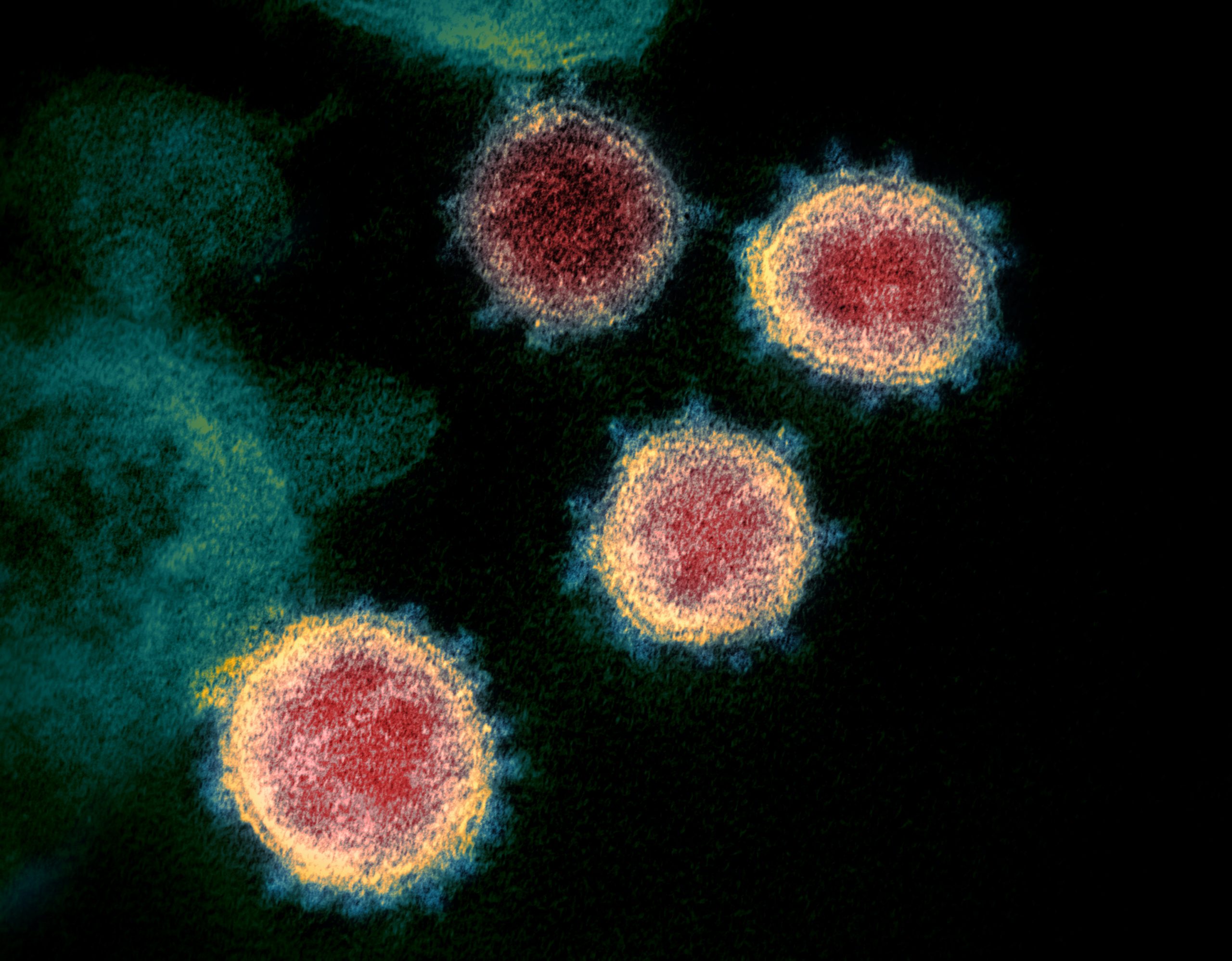 Novel_Coronavirus_SARS-CoV-2-scaled-4