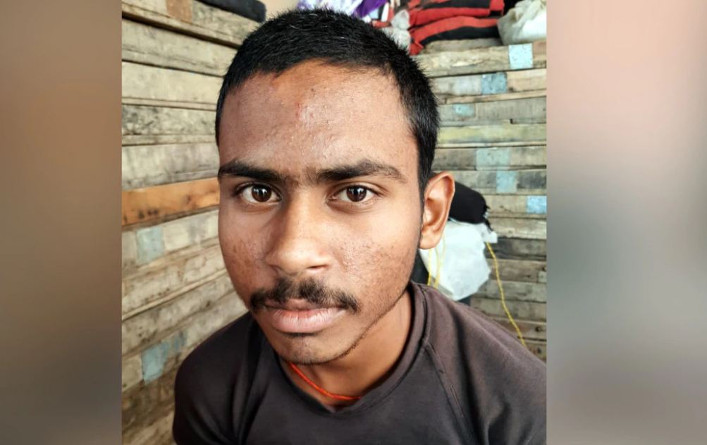 Boy Did Not Go To The Toilet For 18 Months Eats 18 To 20 Rotis Every Day