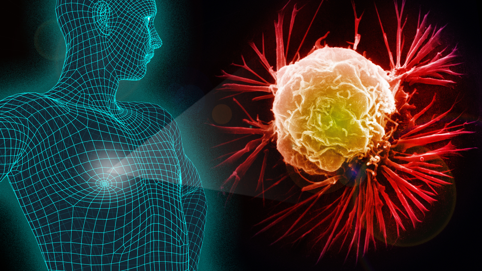 male-breast-cancer-1600x900