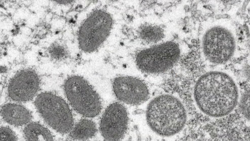 58 Dies In Monkeypox In Congo