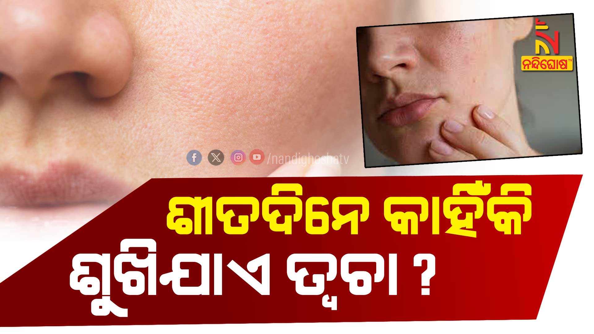 ଶୀତଦିନେ-କାହିଁକି-ଶୁଖିଯାଏ-ଚର୍ମ