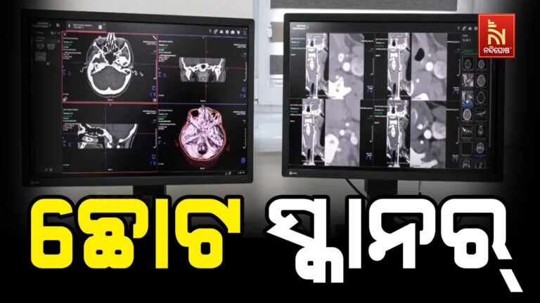 ଚୀନ୍ ତିଆରି କଲା ବିଶ୍ୱର ସବୁଠୁ ଛୋଟ CT ସ୍କାନର!