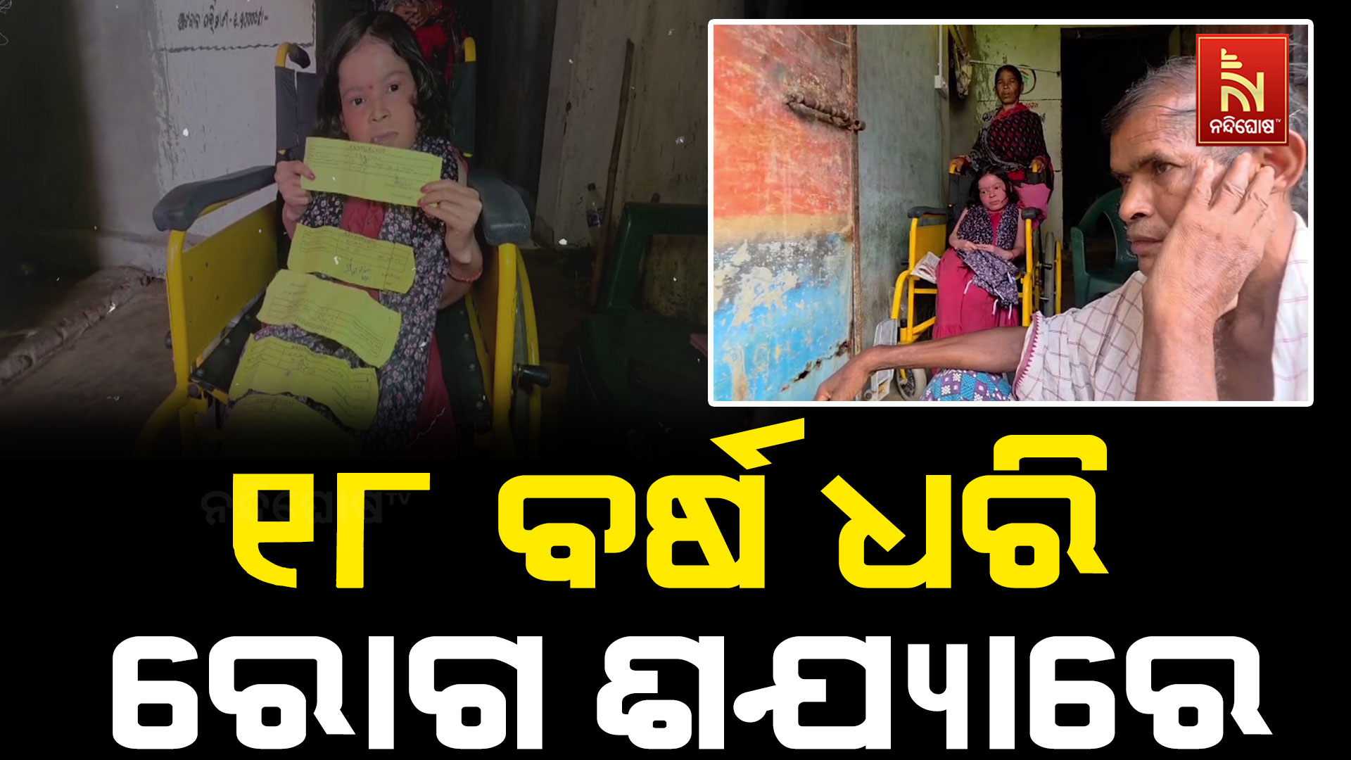 ସୋରିଆସିସ ରୋଗରେ ଆକ୍ରାନ୍ତ ତପସ୍ୱିନୀ, ଚିକିତ୍ସାରେ ଅର୍ଥ ସାଧିଛି ବାଧକ